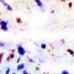 ▓成人蘑菇视频▓
